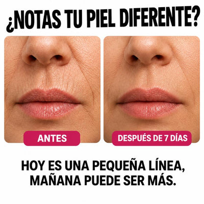 Serum Efecto Tensor